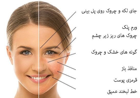 انواع پوست صورت