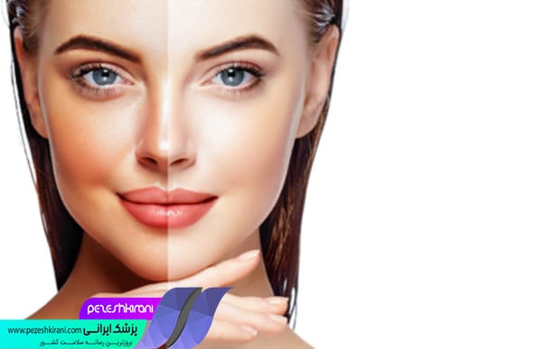 انواع خدمات زیبایی پوست