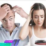 جلوگیری از ریزش مو
