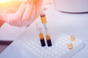 سلول بنیادی موثرین روش برای بازسازی موها